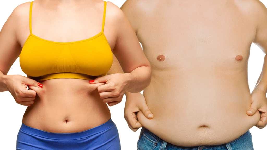 Liposuction perut/paha/lengan/leher(double chin)