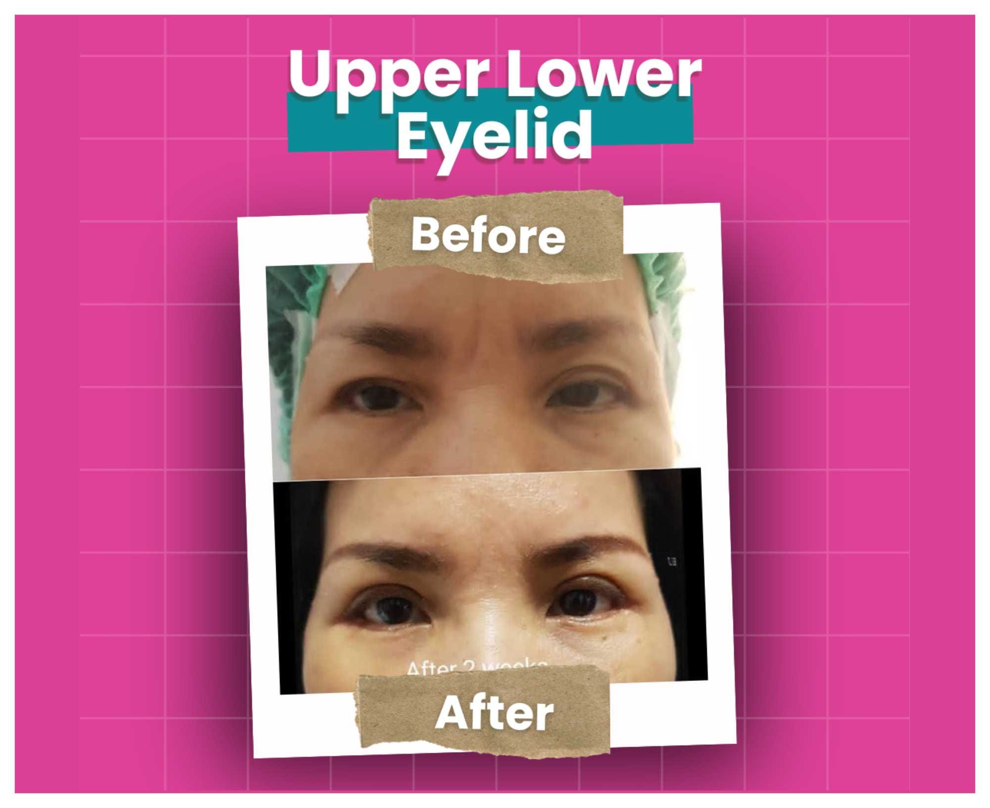 Before After (10)