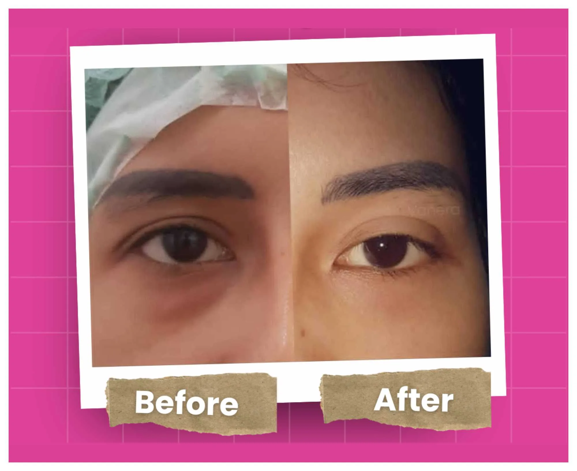 Before After (11)