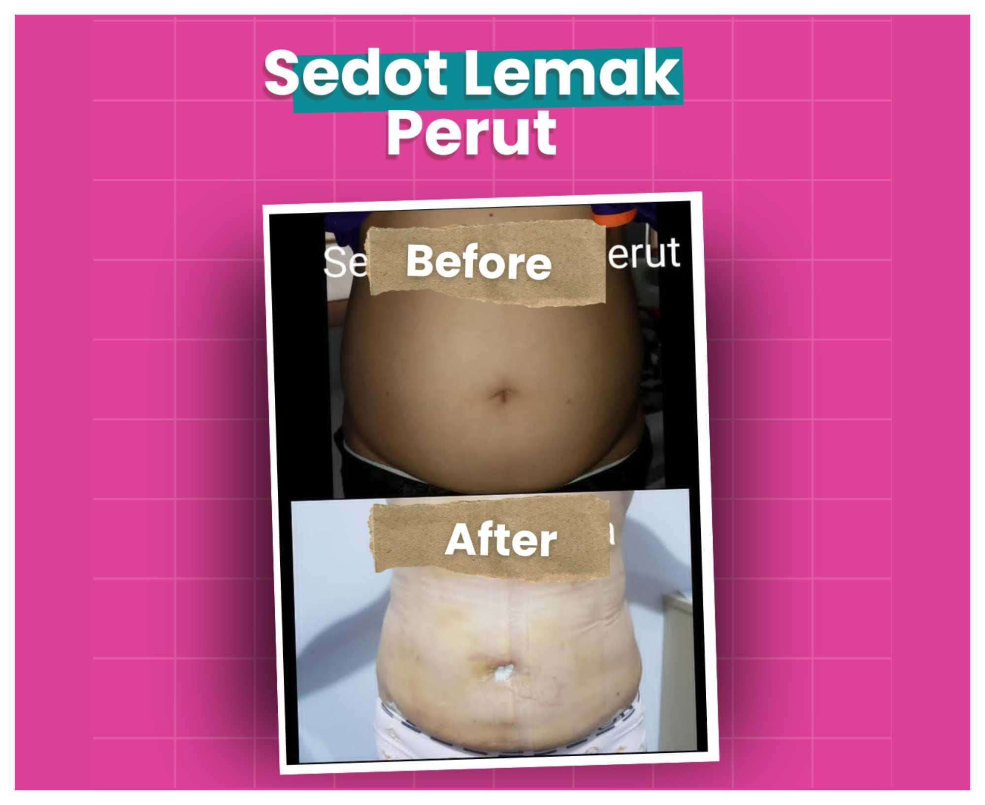 Before After (17)