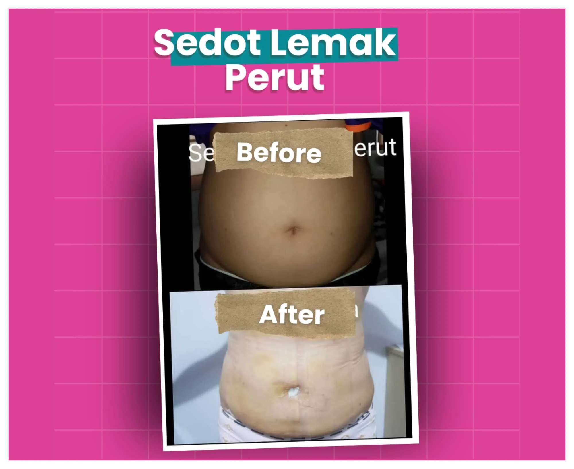 Before After (17)