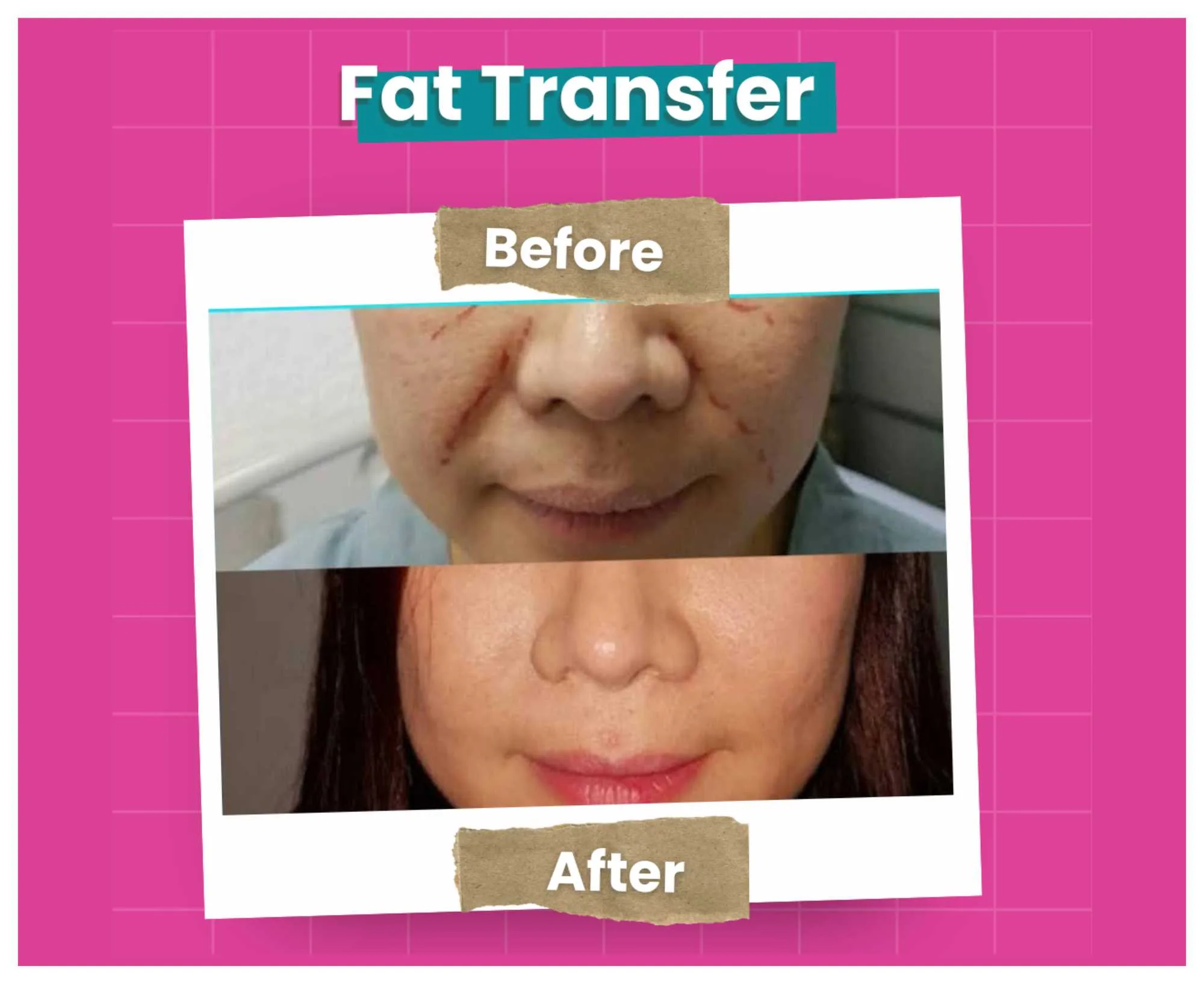 Before After (19)