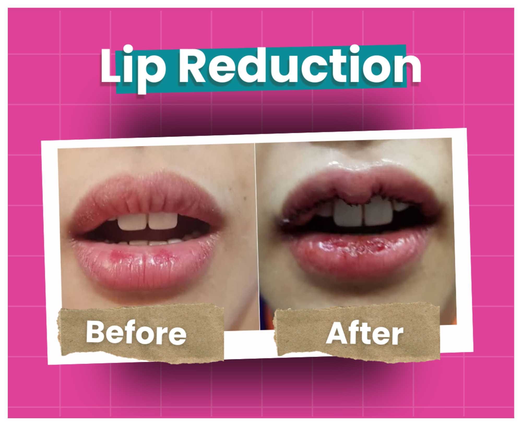 Before After (5)