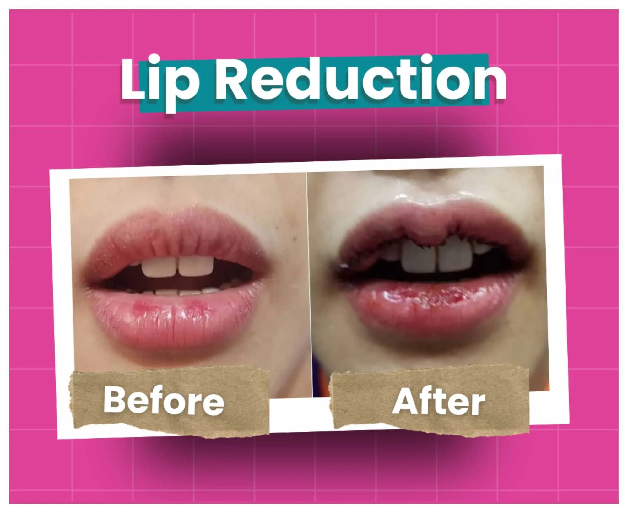 Before After (5)