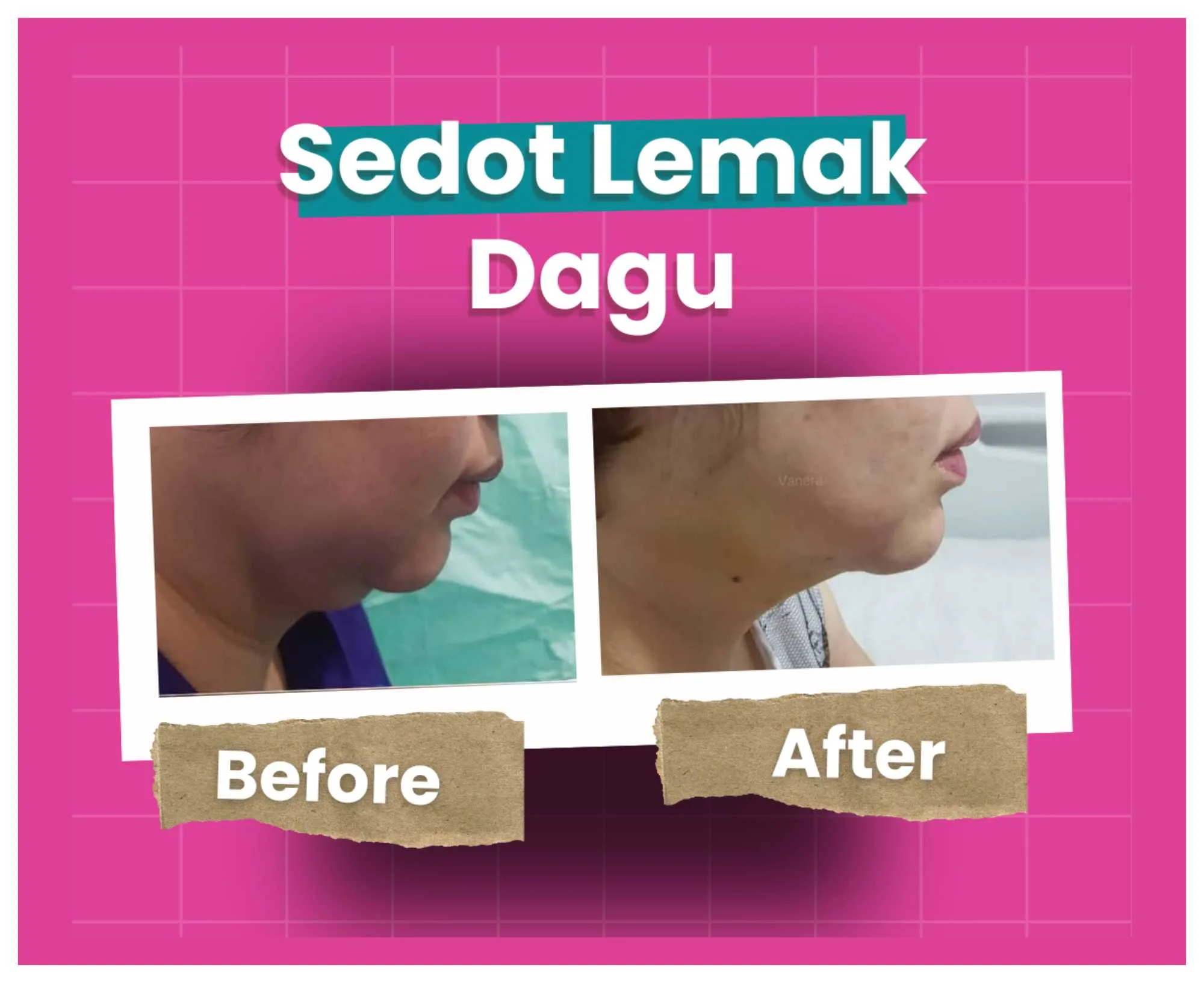 Before After (7)